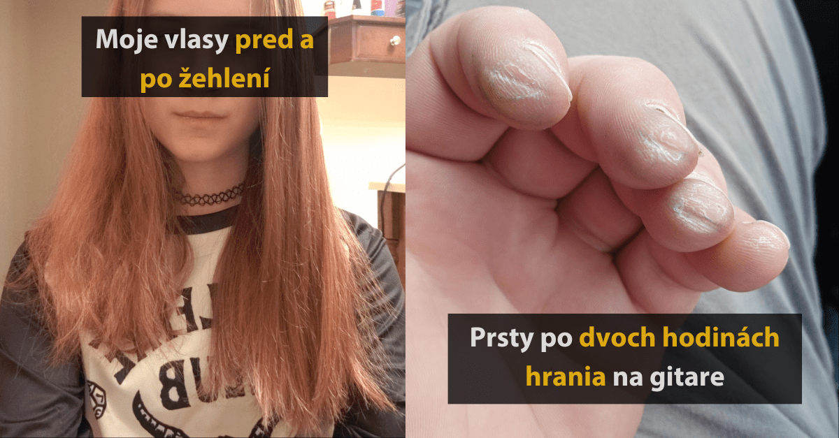16 ľudí sa podelilo o fotografie so svojimi špeciálnymi anomáliami. Človek vie byť zvláštny tvor