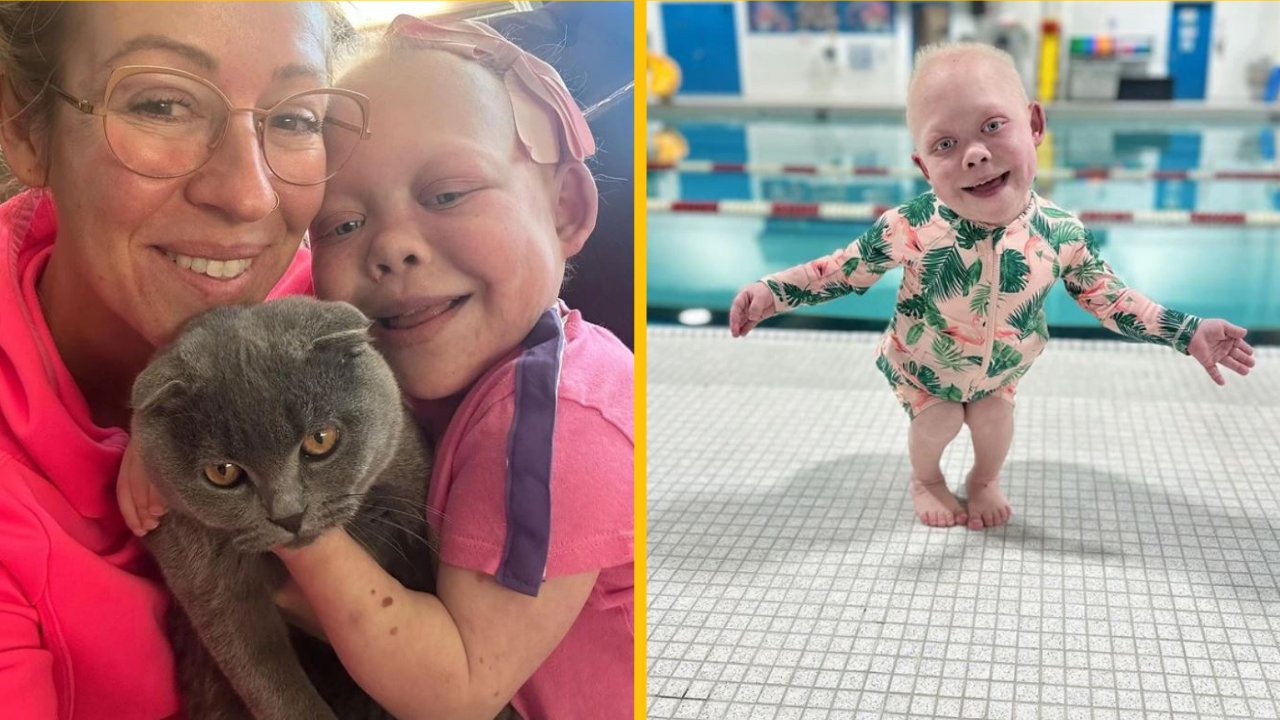 10-ročné dievča, ktoré má telo ako ročné dieťa, prežilo veľa operácií, no čelí výsmechu na internete