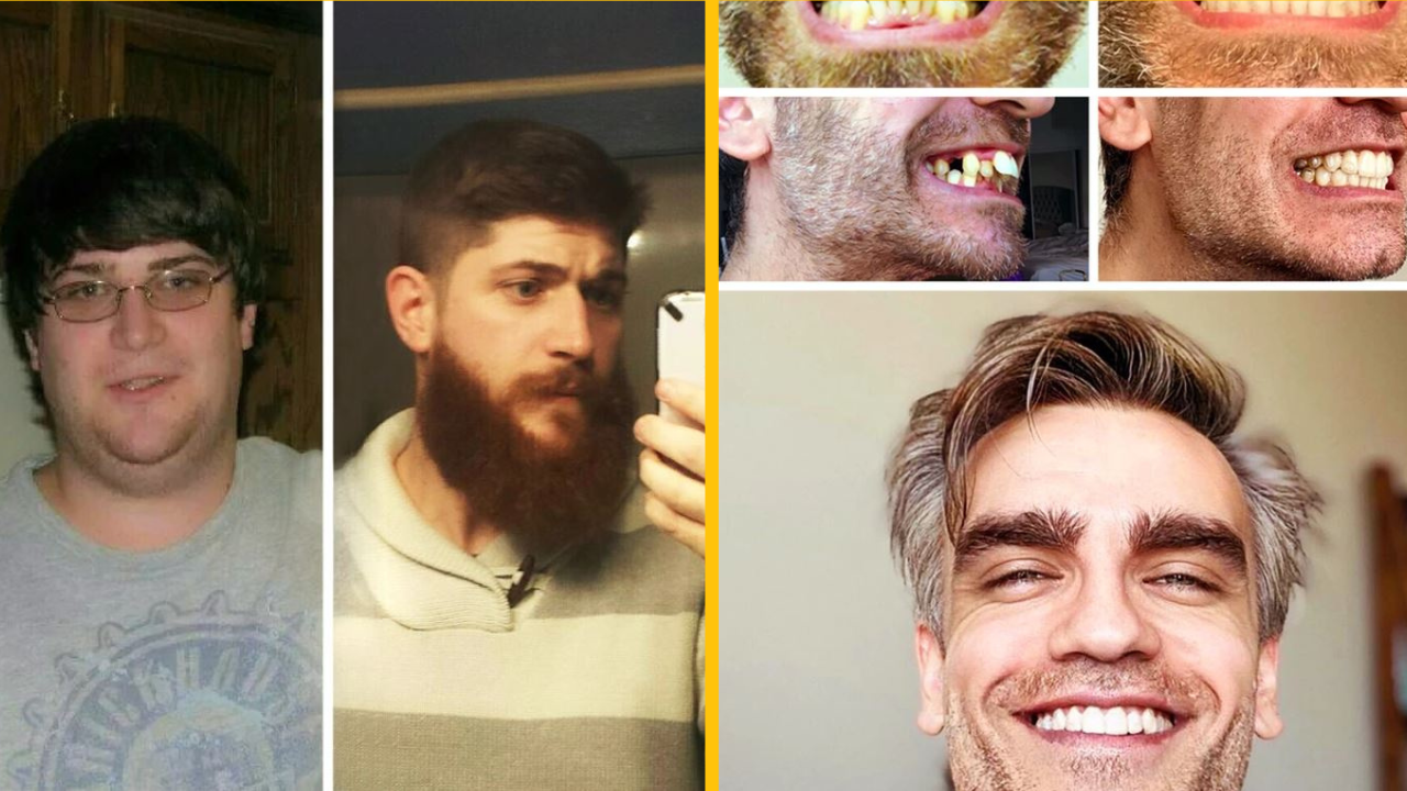 20 mužov, ktorých experimenty s ich vzhľadom dosiahli obrovský úspech