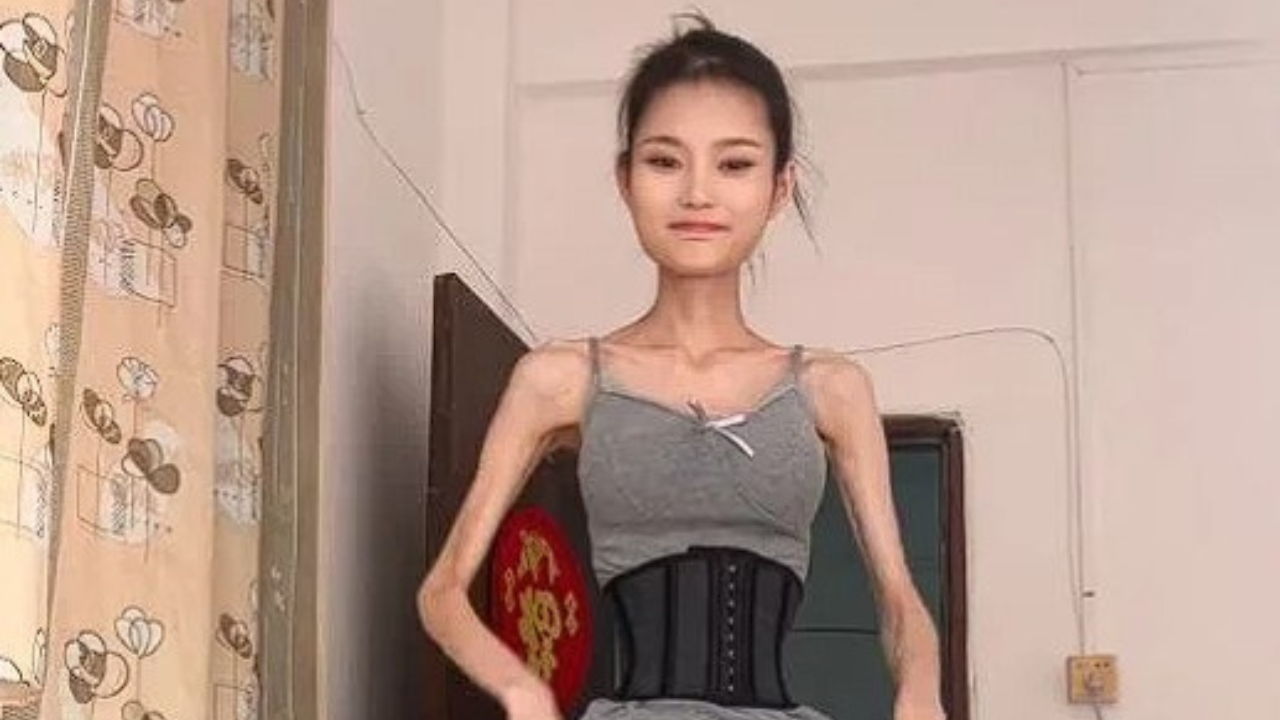Váži len 25 kíl a stále sa snaží schudnúť. Číňanka predvádza svoju chudú postavu vo videách na sociálnej sieti
