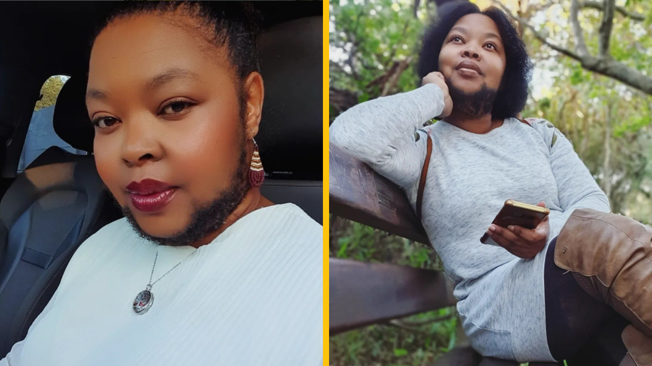 „Som žena s hustou bradou – udržiavať si v lete chlpatú bradu nie je vôbec ľahké“