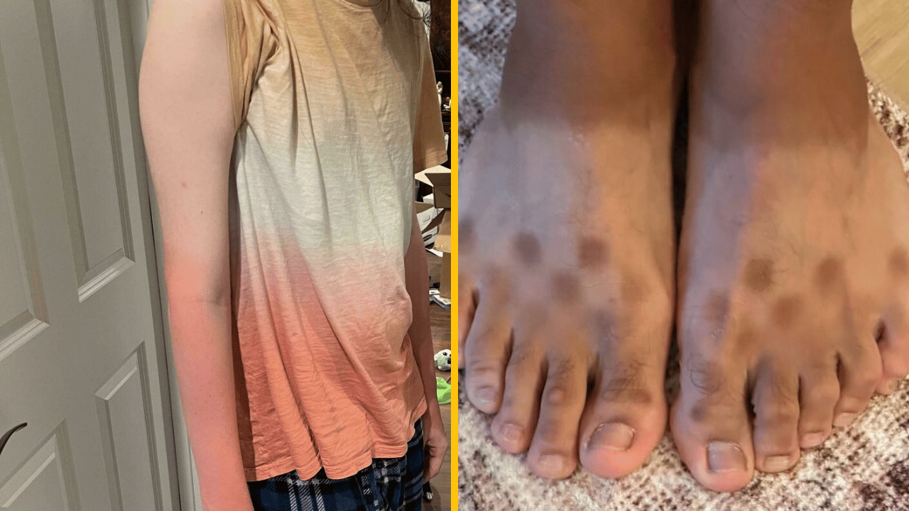 Majstri opaľovania: 10 dôkazov, že si máš natierať SPF