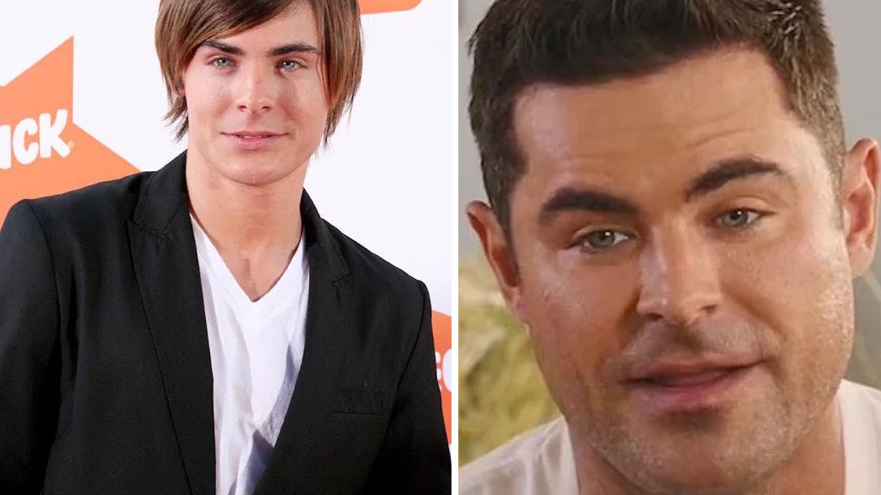 Zac Efron po vážnej nehode: Plastikami zmenený na nepoznanie!