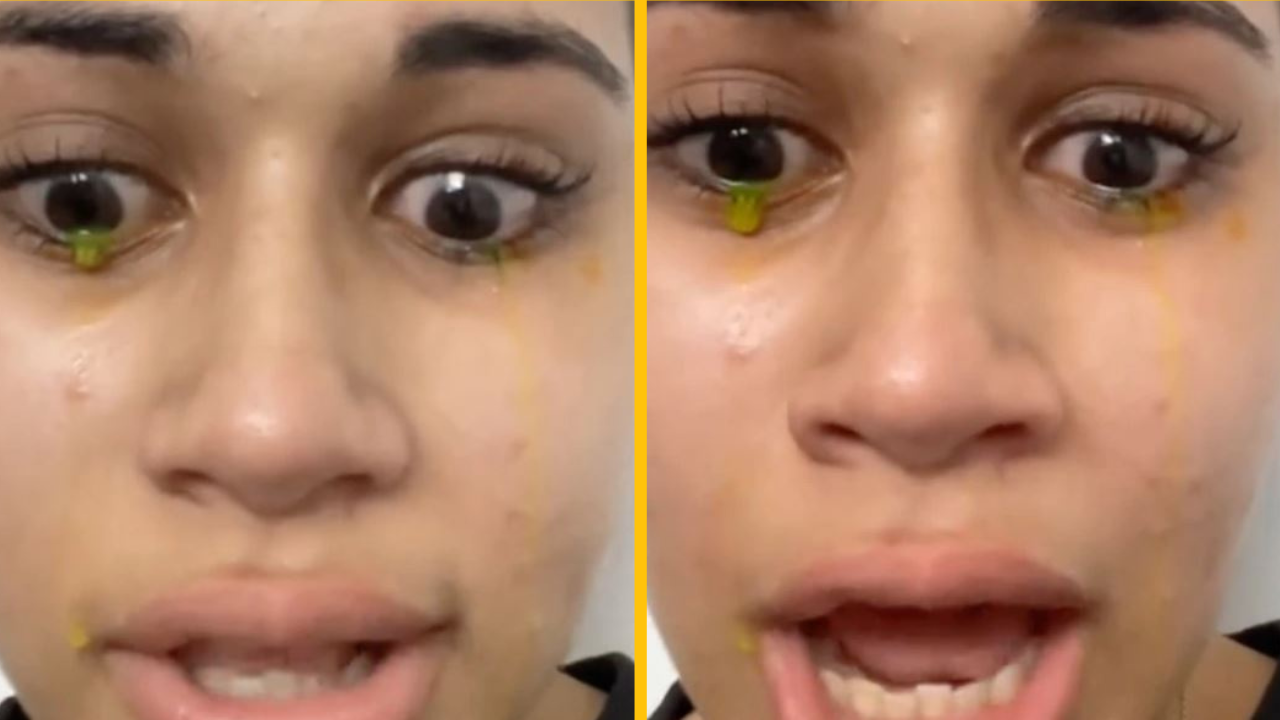 Žena zdieľala video, kde roní žlté slzy: Tu je dôvod, prečo sa to deje