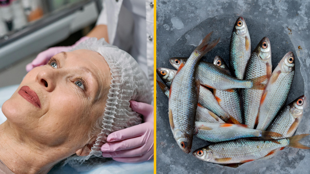 Obľúbená procedúra Kim Kardashian, „spermie lososa“, ovládla Spojené kráľovstvo