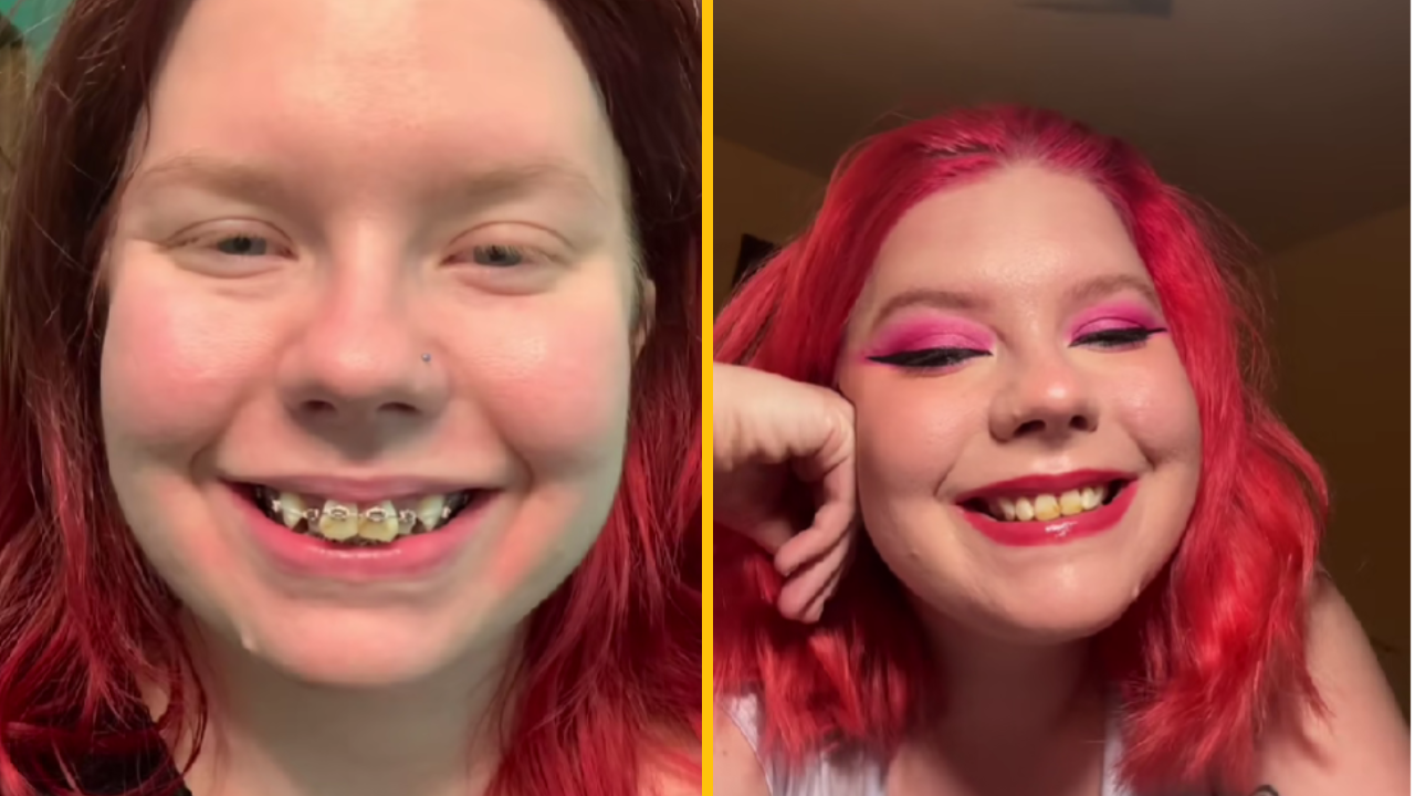 Žena ukázala premenu zubov za 5 800 libier po tom, čo jej rodina povedala, aby sa nesmiala