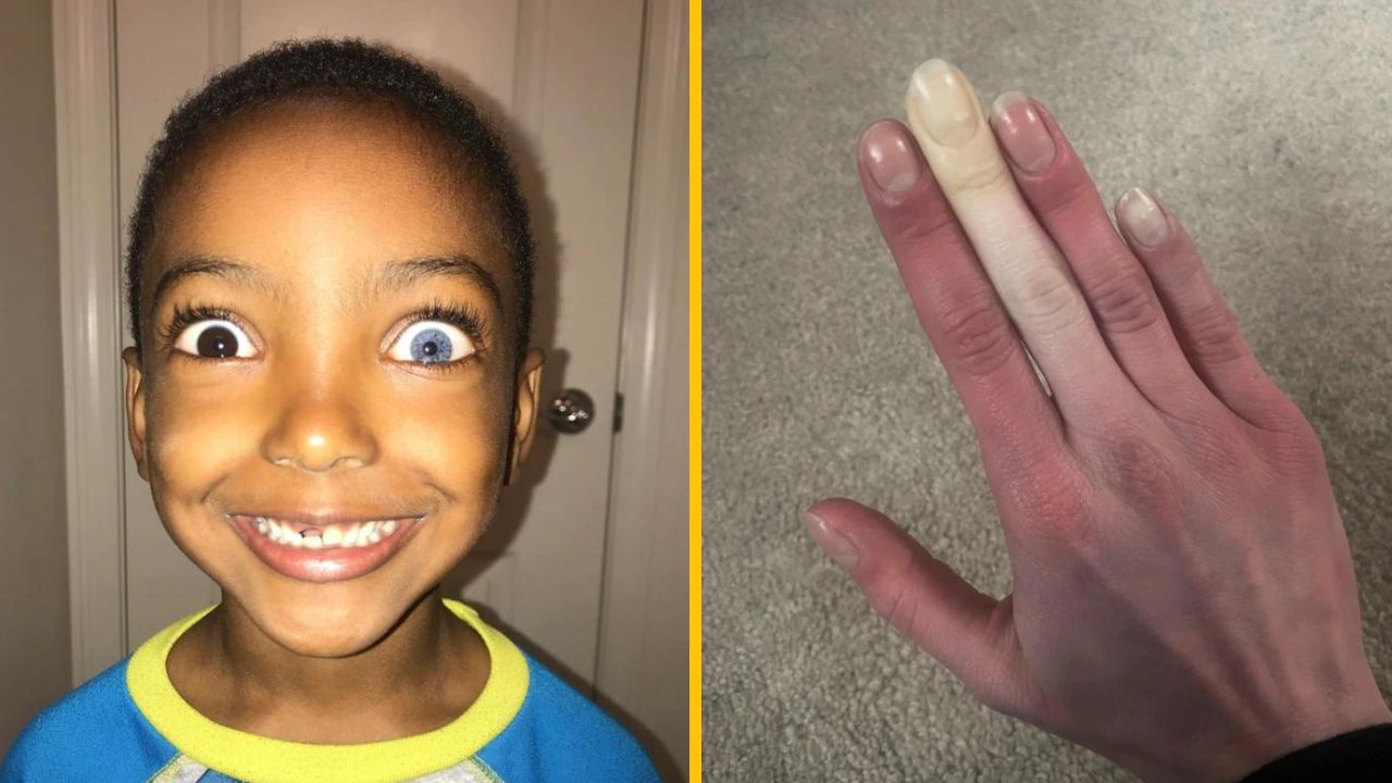 10 fotiek ľudí, ktorí majú telesnú abnormalitu