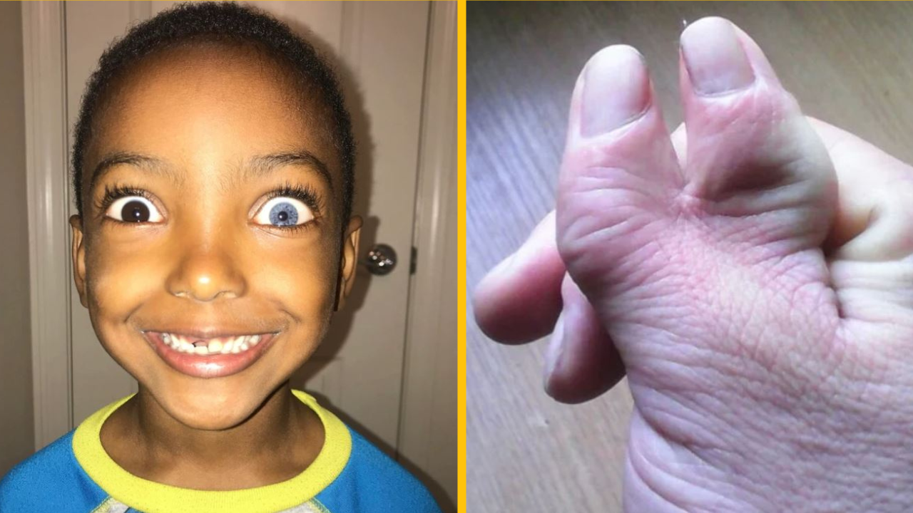 Títo ľudia zdieľali svoju jedinečnú genetiku, ktorá nanovo definuje krásu