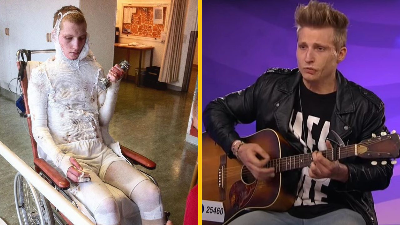 Spevák, ktorý prežil strašný elektrický šok, oslavuje pozoruhodné zotavenie a nový vzhľad