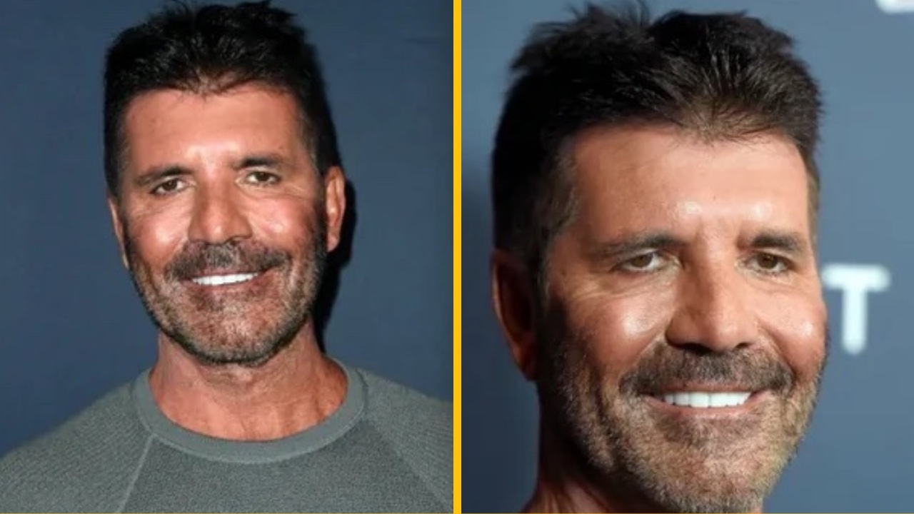 Botox mu bráni v mimike: Porotca Simon Cowell je po plastikách úplne iný človek!