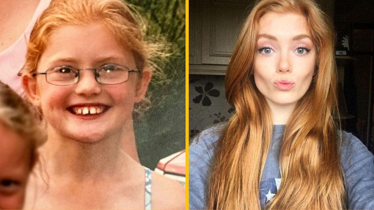 V škole sa jej vysmievali, potom sa stala najkrajšou ženou krajiny