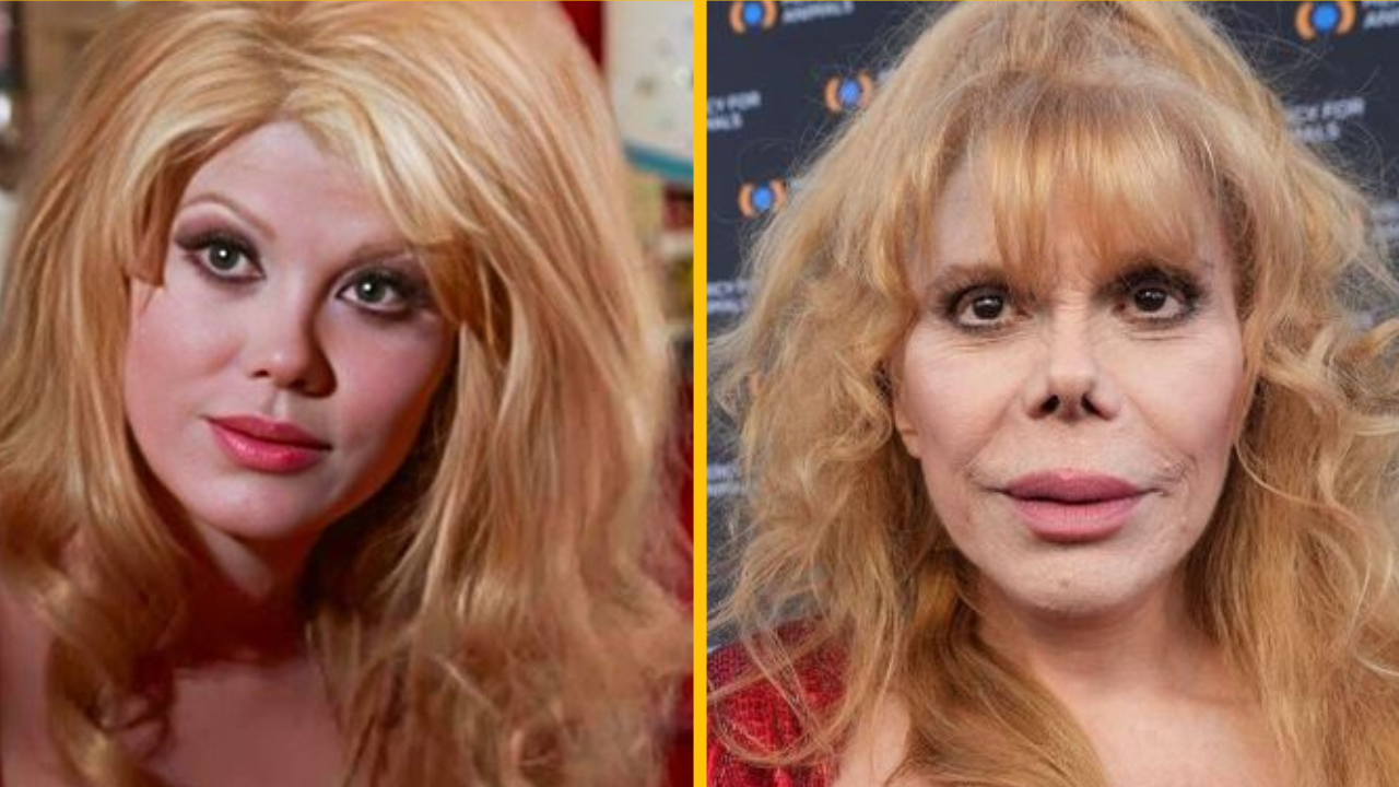 10 celebrít, ktoré sa v priebehu rokov dramaticky zmenili