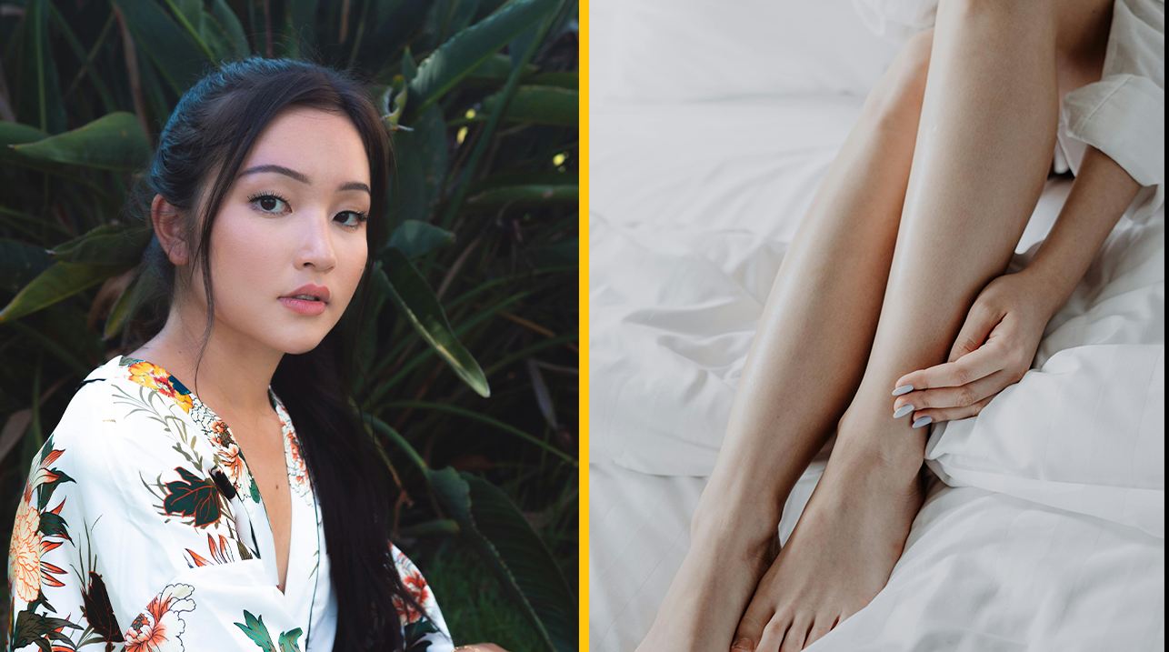 „Merala som len 157 cm, tak som zaplatila 60 000 € za extrémne bolestivú procedúru predĺženia nôh.“