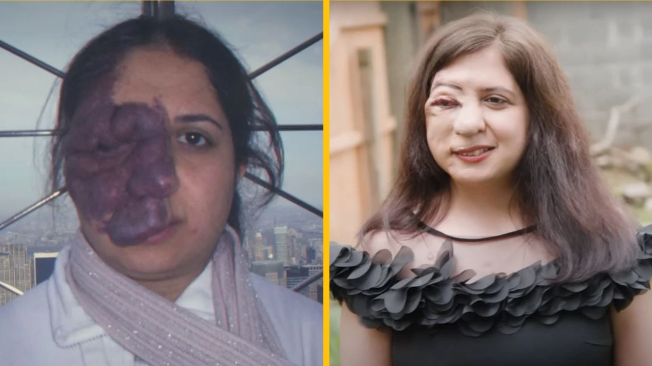 „Ľudia hovorili, že by som nemala vychádzať z domu,“ Žena po rokoch znovu nadobudla sebavedomie