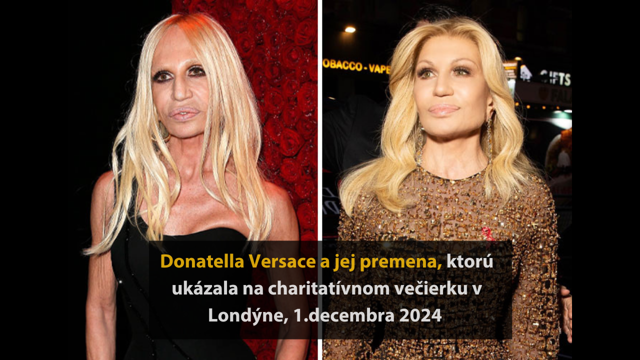 10 celebrít, ktoré v roku 2024 prešli najväčšou zmenou #1