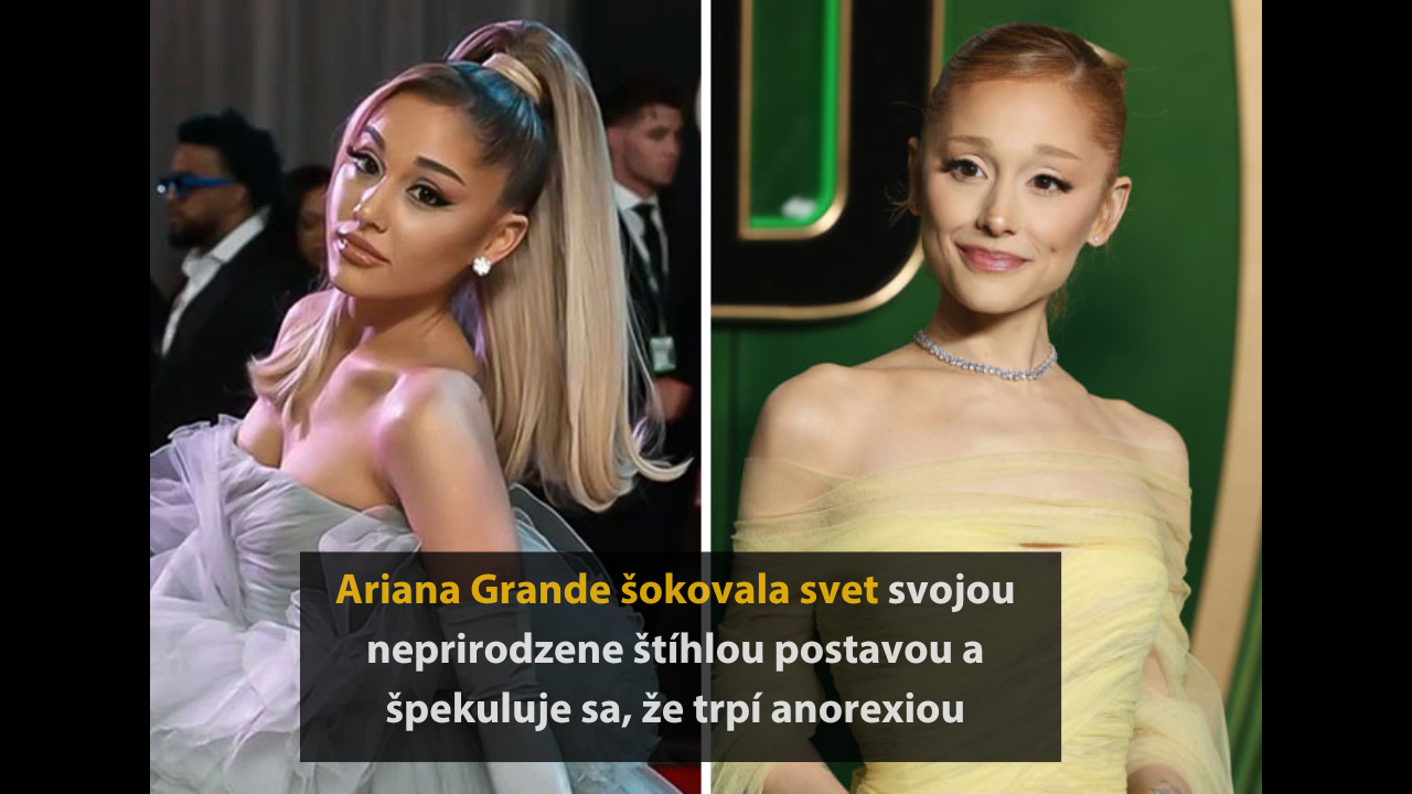 10 celebrít, ktoré v roku 2024 prešli najväčšou zmenou #2