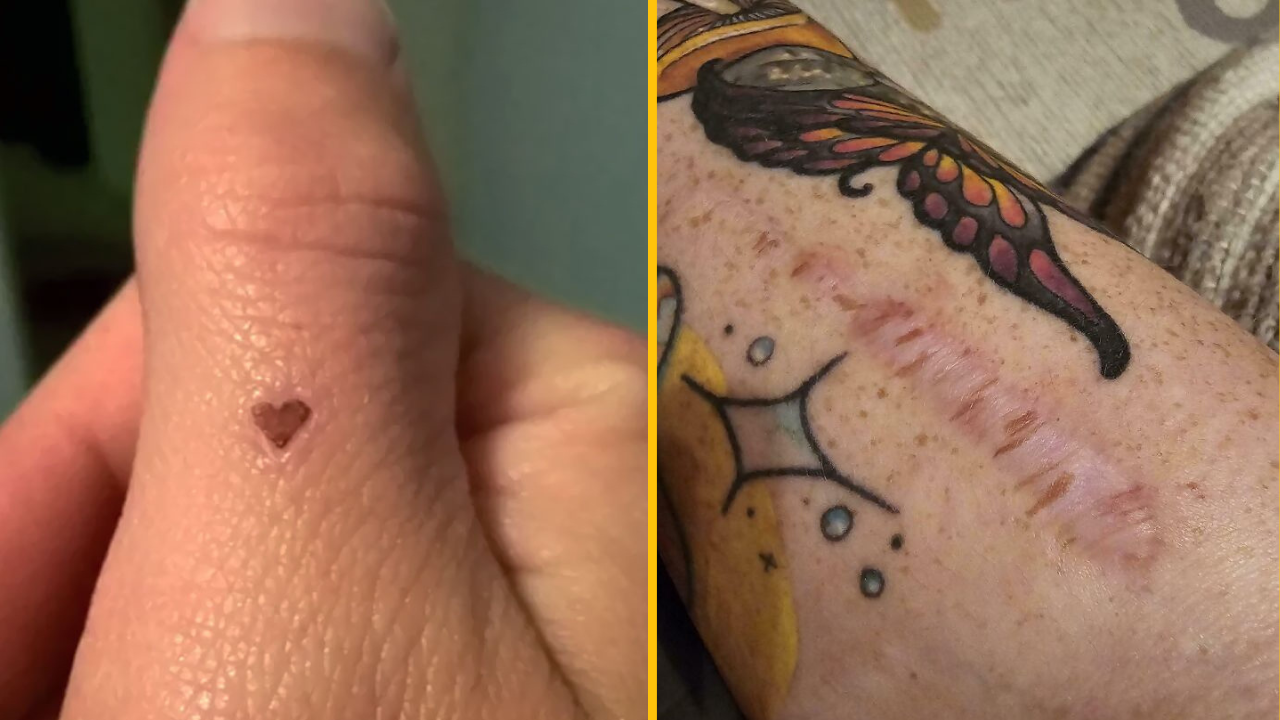 13 fotiek, ktoré ukazujú, aké je ľudské telo fascinujúce #1