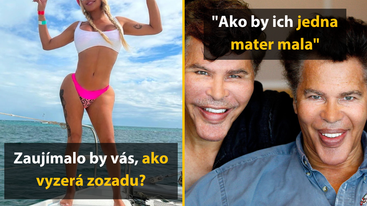 15 prípadov, keď plastické operácie nevyšli podľa očakávaní