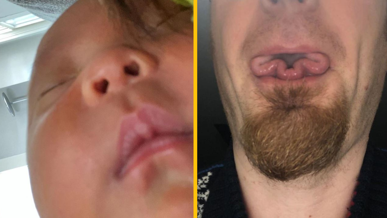 16 ľudí, ktorí majú na svojom tele malý pozdrav od prírody