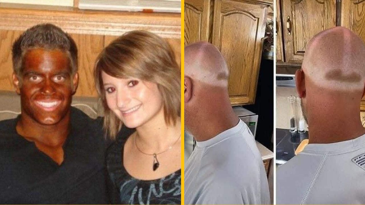 10 vtipných fotografií nešťastníkov, ktorých opálenie nedopadlo podľa predstáv