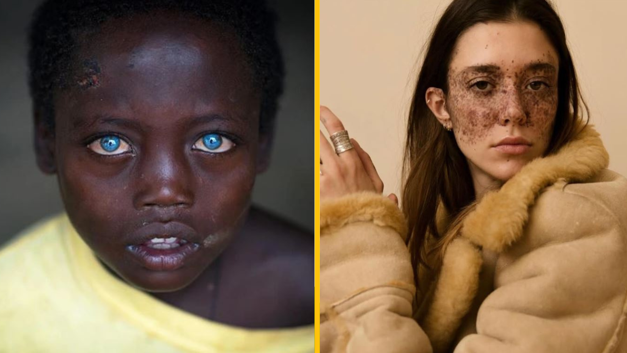 10+ nezvyčajných ľudí, ktorých vzhľad je pre tento svet príliš ohromujúci