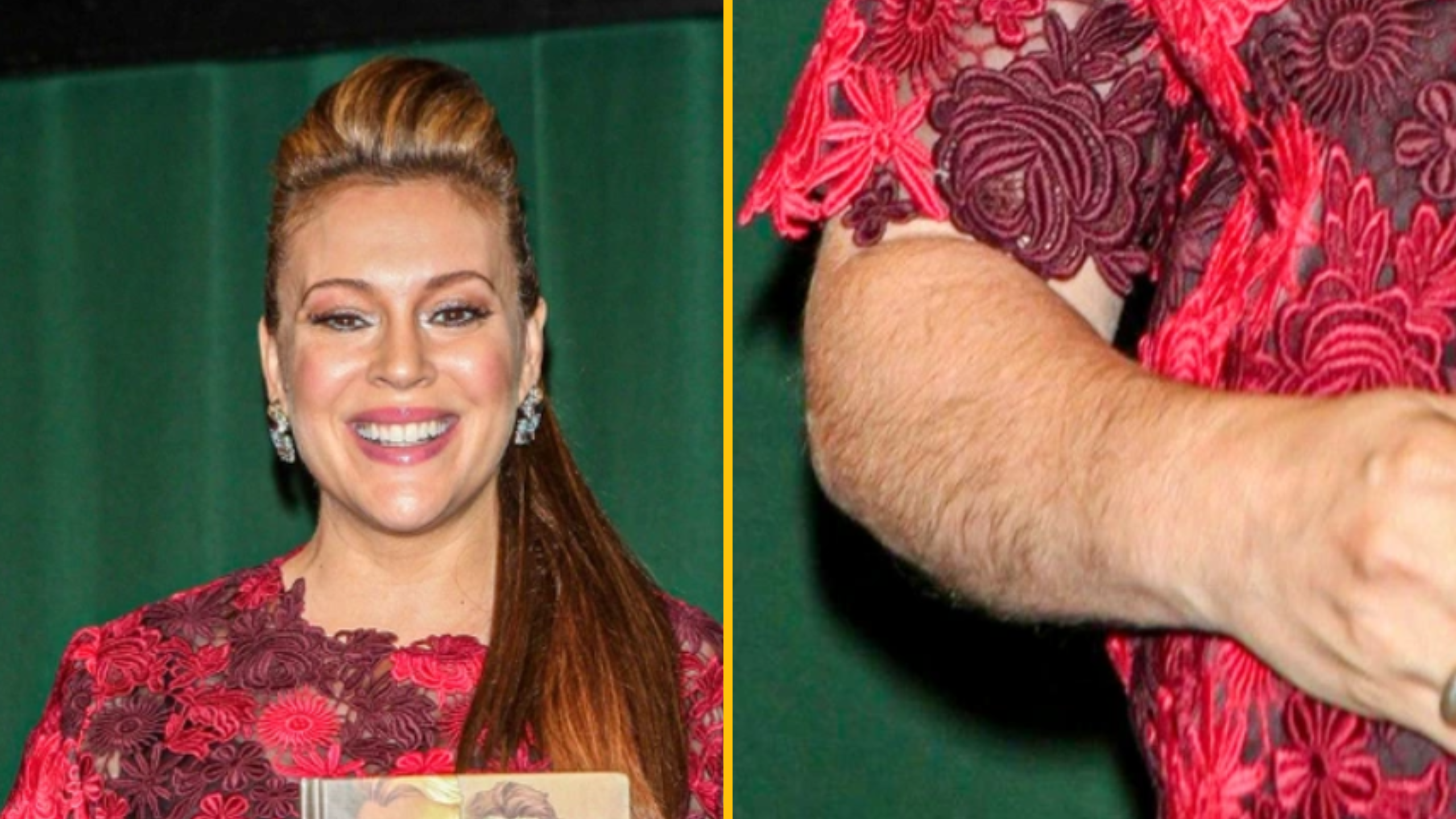 15+ celebrít, ktoré odmietajú prispôsobiť sa štandardom krásy