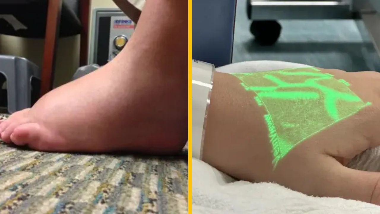 Červený pot alebo zašívanie mravcami: 10 fascinujúcich faktov o ľudskom tele aj s obrázkami