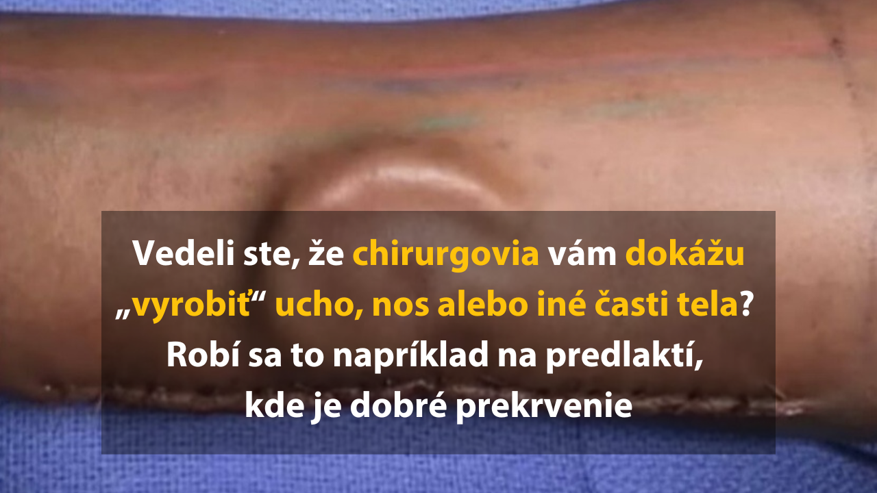 13 fotiek, ktoré ukazujú, ako je ľudské telo úžasné, ale trochu aj desivé
