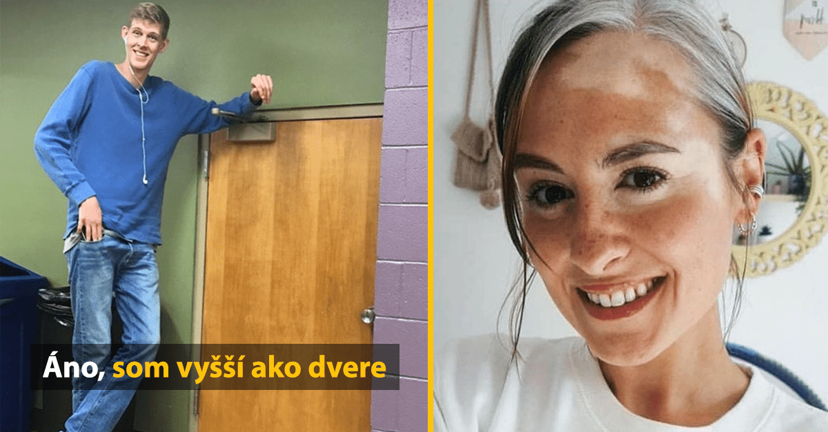 15 ľudí, ktorí svojim vzhľadom priťahujú všetku pozornosť