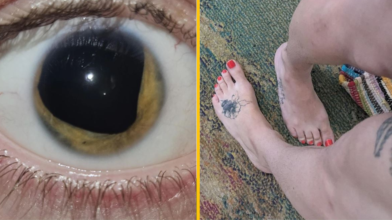 14 neobvyklých vlastností ľudského tela, ktoré robia ich majiteľov jedinečnými