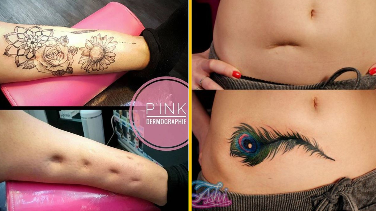 15 prípadov, keď tatéri premenili jazvy na umelecké diela