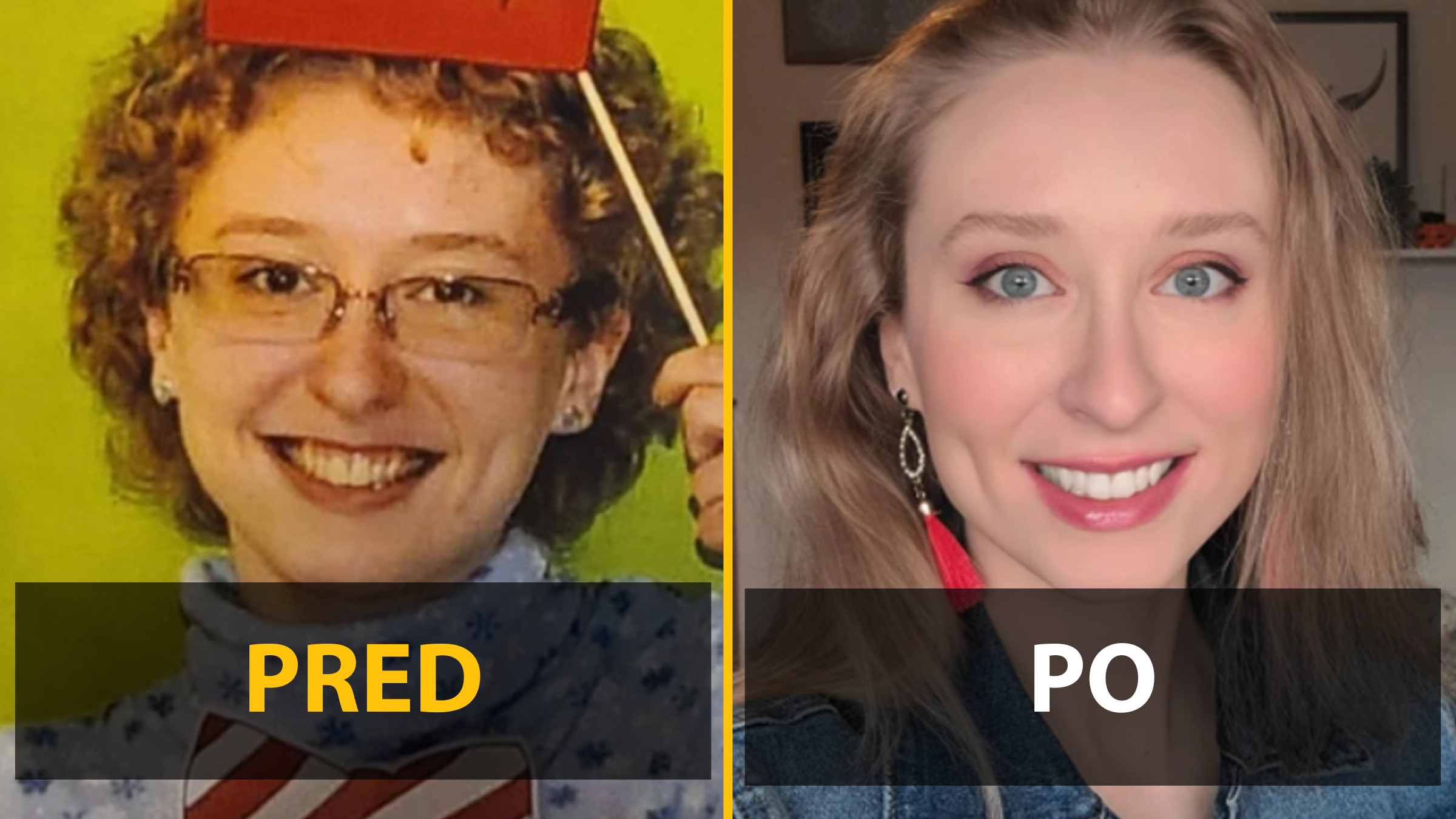 13 ľudí zdieľa fotografie Pred a Po