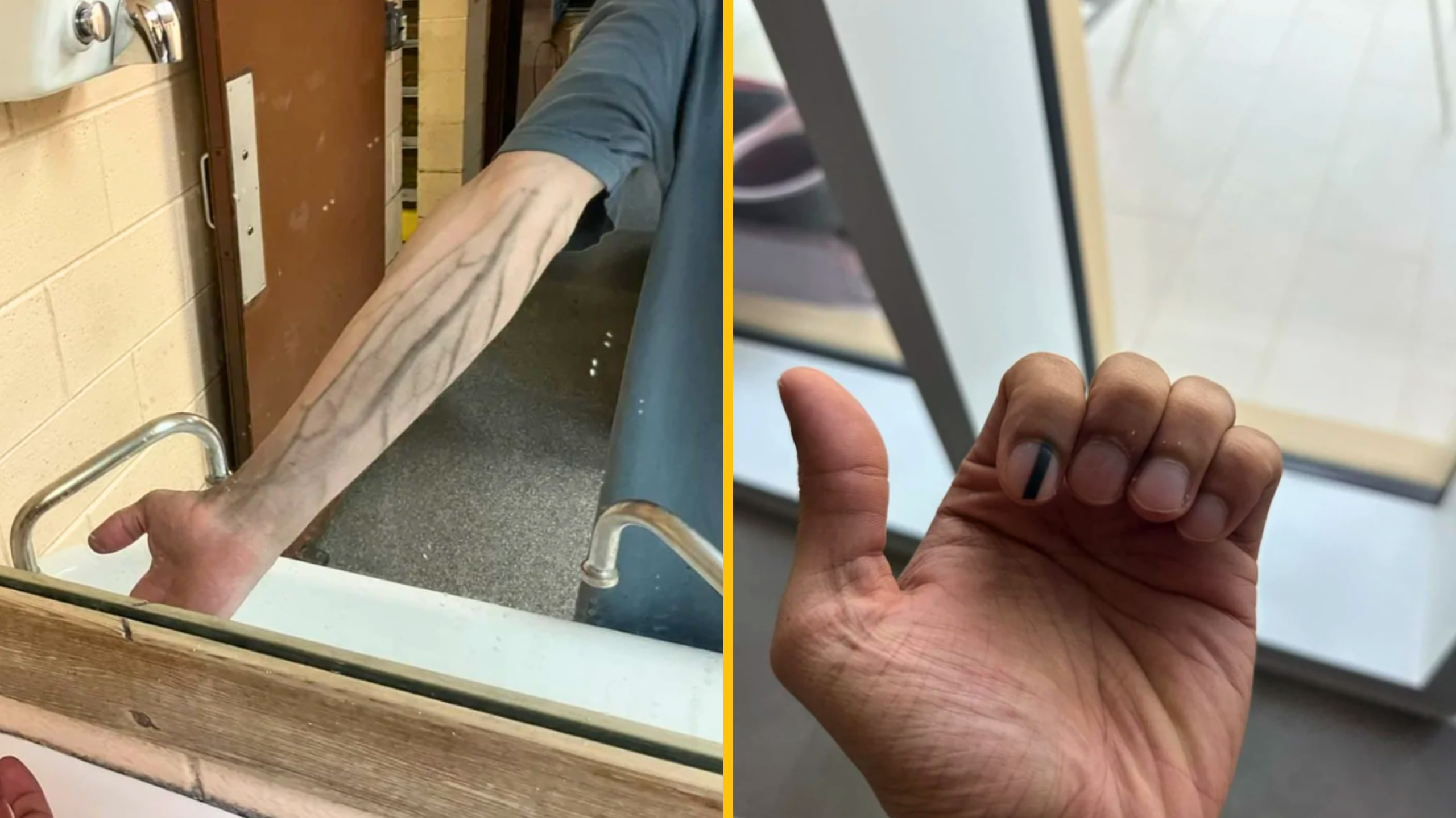 12 fascinujúcich fotografií ľudí s výnimočnými telesnými črtami