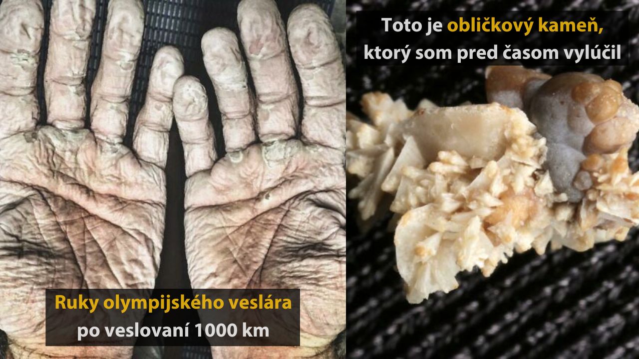 10 fascinujúcich až strašidelných vecí, ktoré sa môžu stať ľudskému telu #1