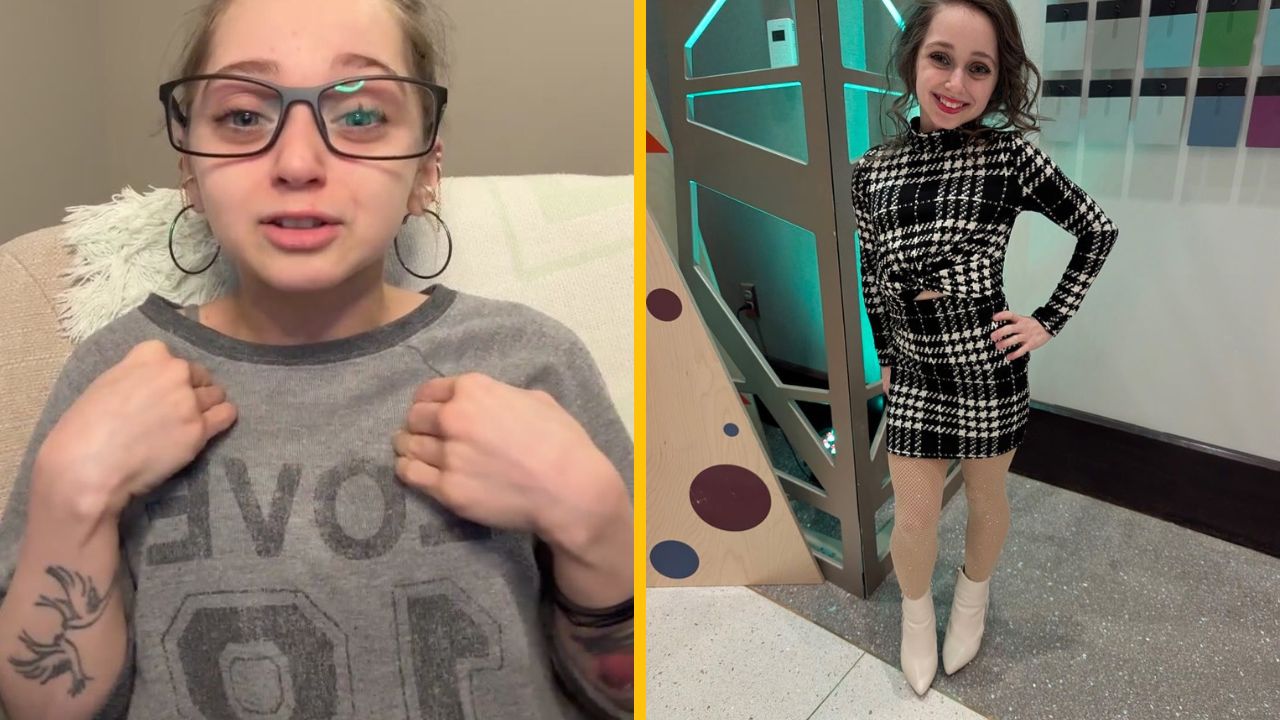 Žena má 25, ale vyzerá ako 8-ročná: Diagnostikovali jej hypofyzárny nanizmus