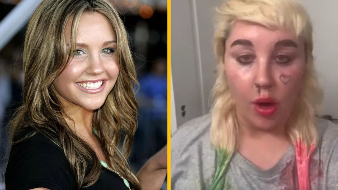 Amanda Bynes oznámila, že začína brať lieky na cukrovku, aby schudla kvôli paparazzom