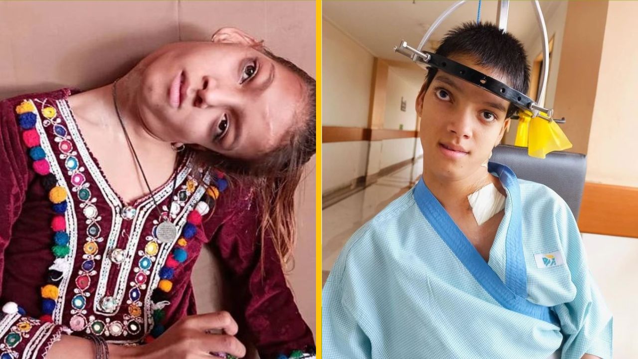 Šokujúci 90-stupňový krk bol konečne napravený a dievča získalo nový život