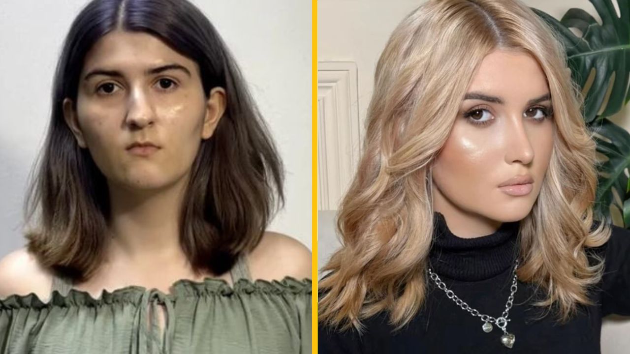 Neuveriteľná premena ženy po operácii v Južnej Kórei sa stala virálnou