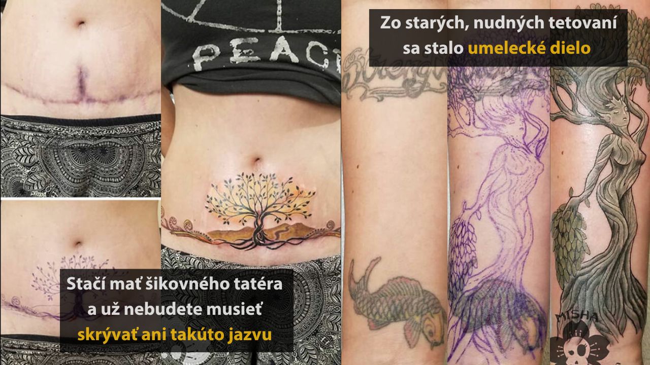 Ľudia, ktorí vďaka novým tetovaniam dostali druhú šancu, 1.časť
