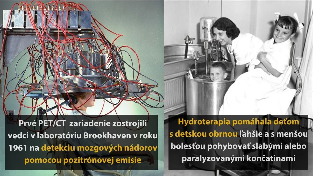 6 zaujímavých až desivých medicínskych procedúr, ktoré položili základy modernej medicíny, 2.časť