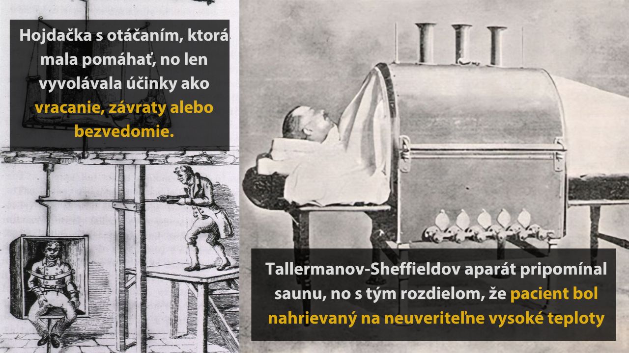 6 zaujímavých až desivých medicínskych procedúr, ktoré položili základy modernej medicíny, 3.časť