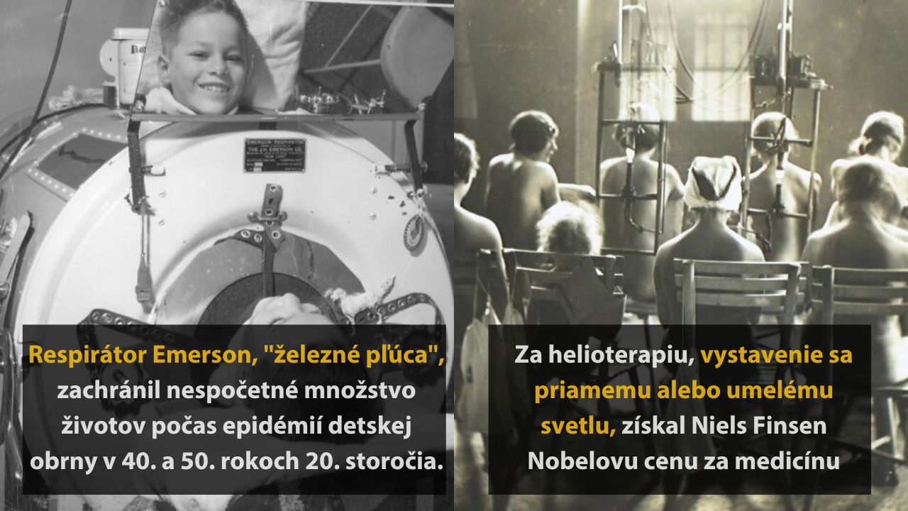 6 zaujímavých až desivých medicínskych procedúr, ktoré položili základy modernej medicíny, 1.časť
