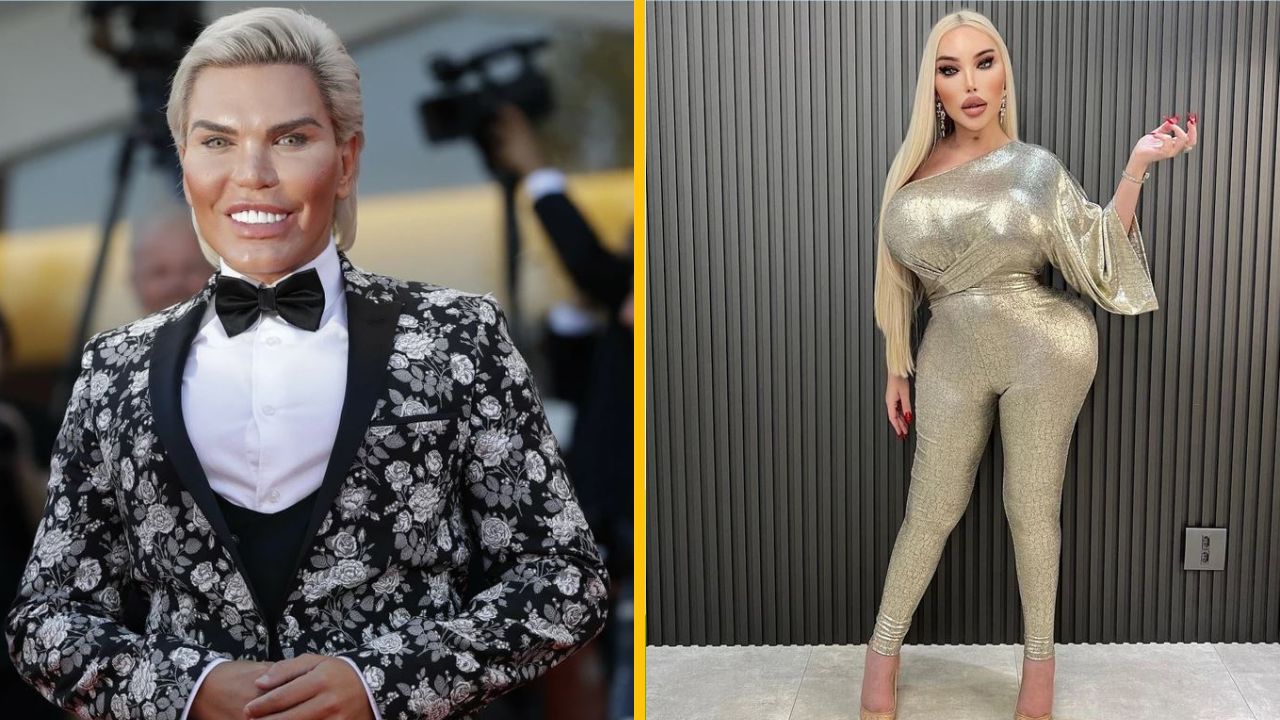 Jessica Alves, ktorá na premenu minula viac než milión dolárov, už prestala podstupovať operácie