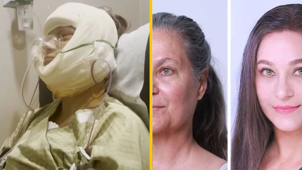 „Mama premenená na dcéru!“ Žena vyhrala premenu na kórejskej klinike a ľudia obdivujú jej krásu