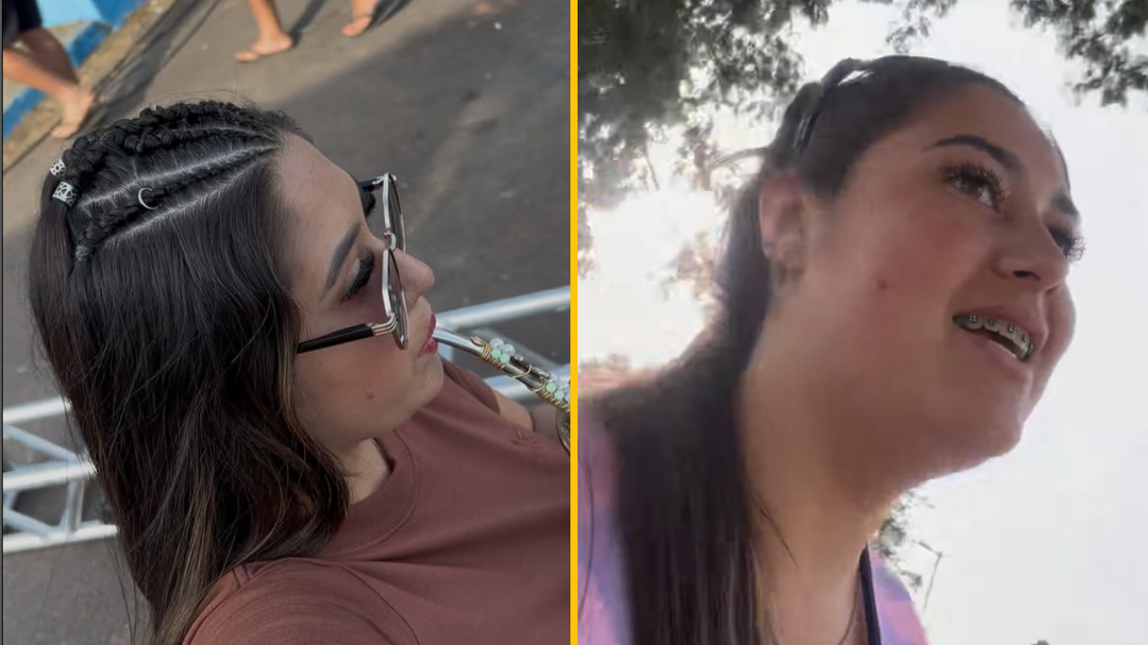 Žene narástli prsia do obrovských rozmerov až tak, že potrebovala vozík