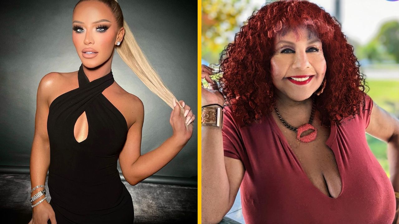 11 slávnych žien, ktoré mali hrozné následky po kozmetických zákrokoch na čiernom trhu