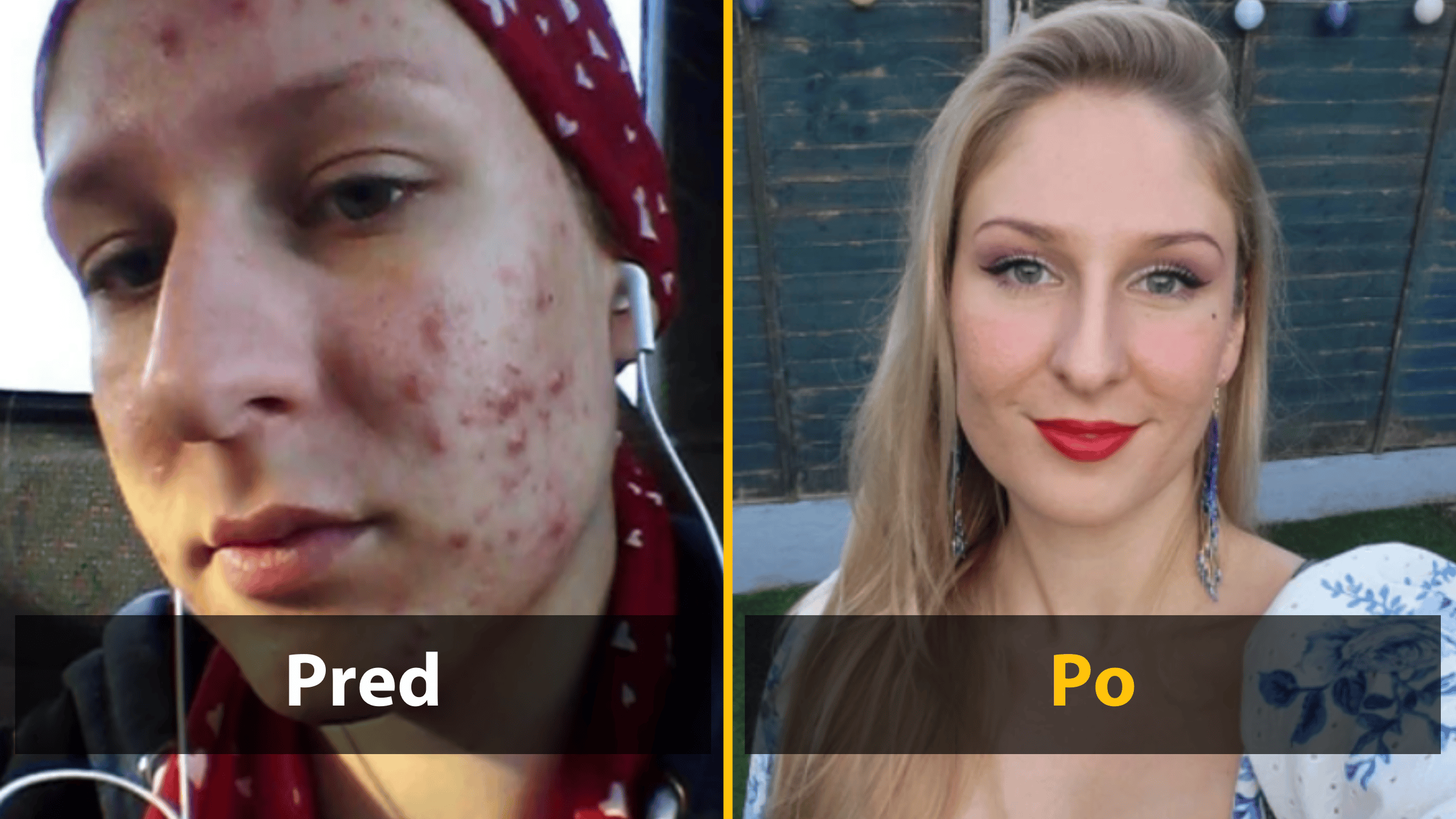 11 fotografií „Pred a Po“