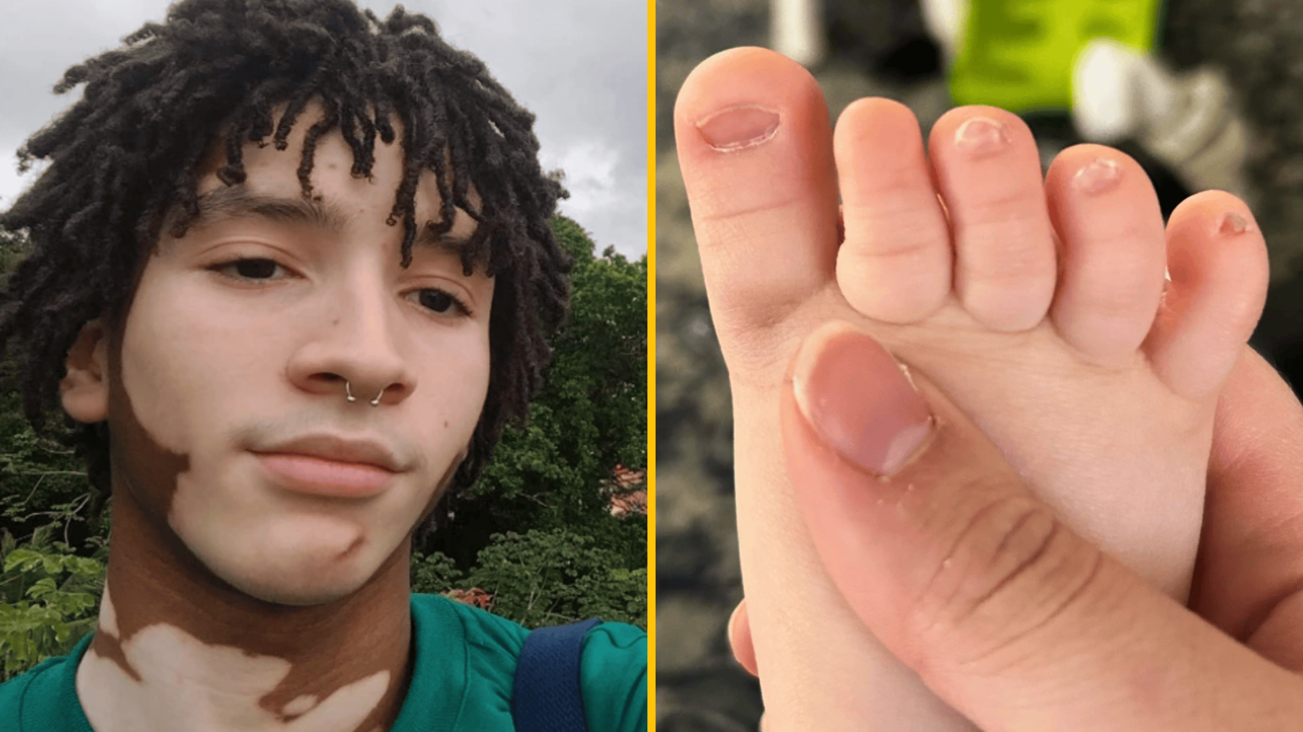 10 ľudí, ktorých príroda obdarila svojou mágiou