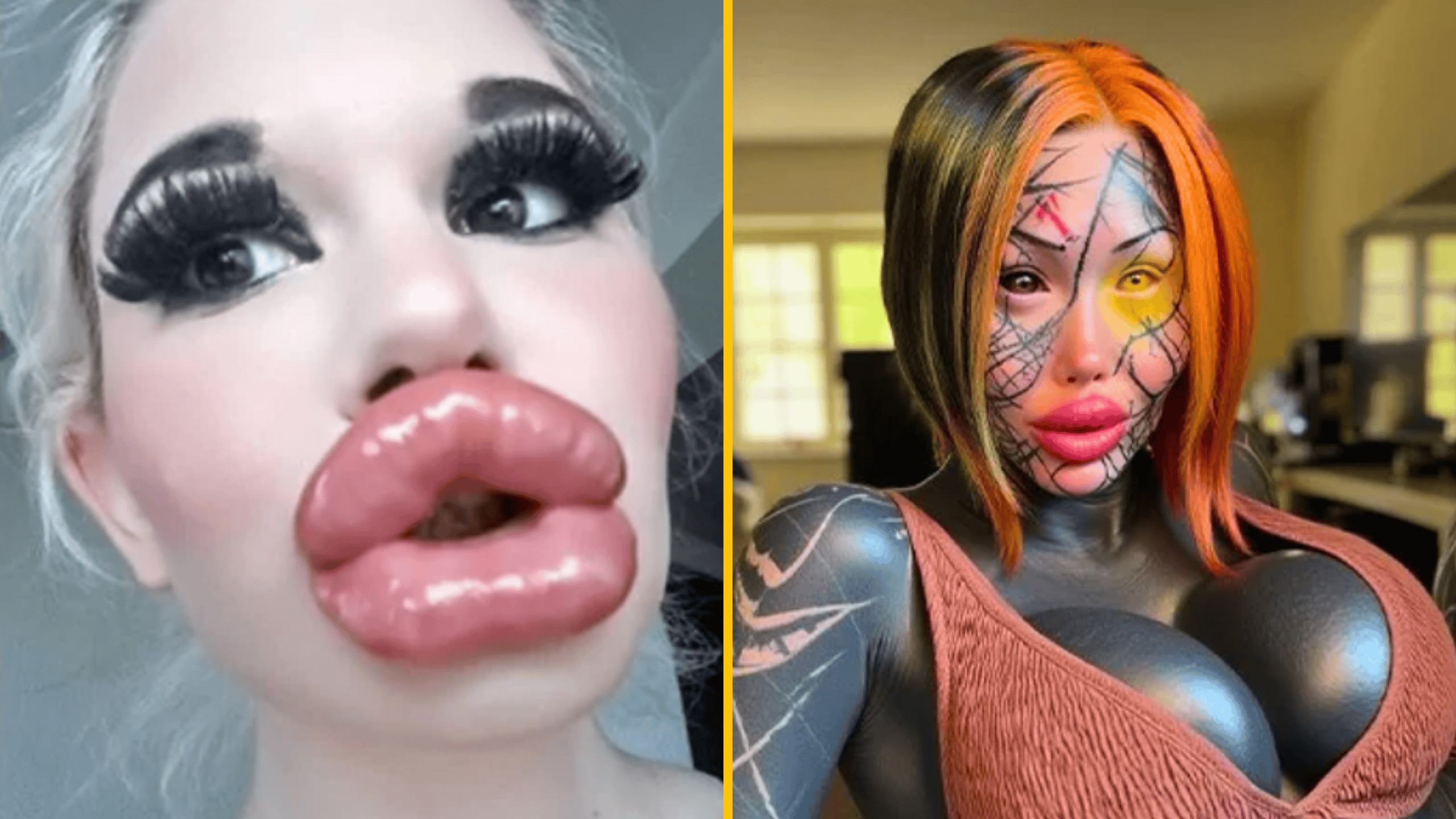 10 obyčajných ľudí, ktorí sa stali slávnymi vďaka plastickej chirurgii