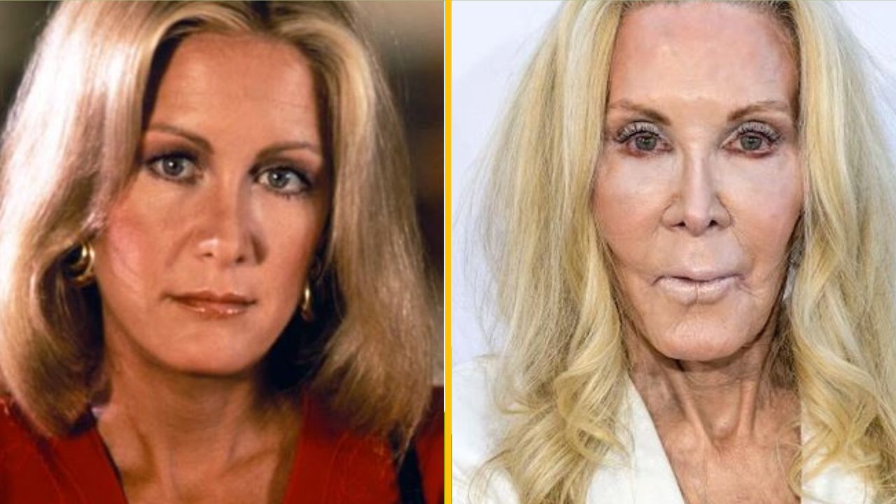 13 celebrít, ktoré sú po kozmetických zákrokoch takmer na nerozoznanie